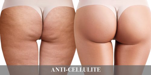 Anti-cellulite