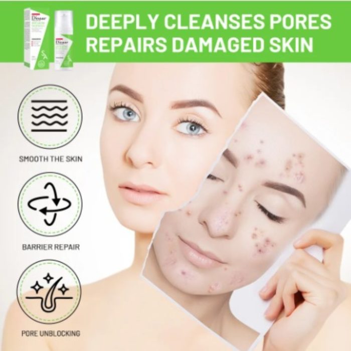 Anti-Acne gezichtsserum met met Salicylzuur, Ceramide en Zoethoutwortel - Afbeelding 3