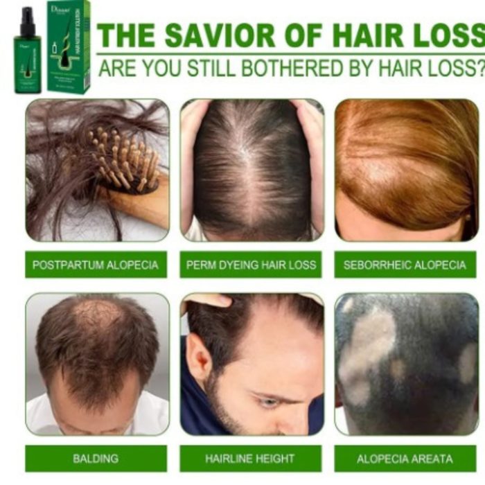 Anti-haaruitvalbehandeling natuurlijke gemberwortel en meloen snelle haargroeiserum haargroeiolieserum voor mannen en vrouwen